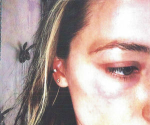 AMBER HEARD POBIŁA SIĘ SAMA?