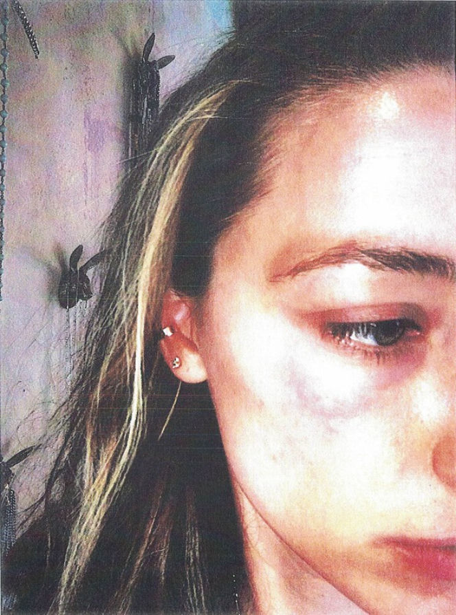 AMBER HEARD POBIŁA SIĘ SAMA?