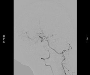 W Mazowieckim Szpitalu Specjalistycznym przeprowadzono nowatorskie zabiegi neurologiczne