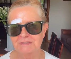 Barbara Busztynowicz miała wypadek! Skończyło się szyciem. Nikt się nie zatrzymał