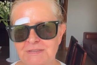 Barbara Busztynowicz miała wypadek! Skończyło się szyciem. Nikt się nie zatrzymał