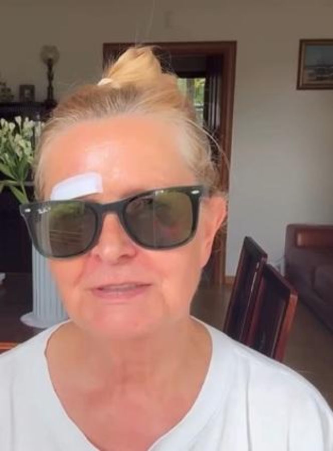 Barbara Busztynowicz miała wypadek! Skończyło się szyciem. "Nikt się nie zatrzymał"