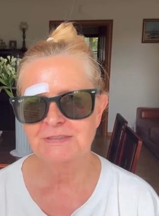 Barbara Busztynowicz miała wypadek! Skończyło się szyciem. "Nikt się nie zatrzymał"