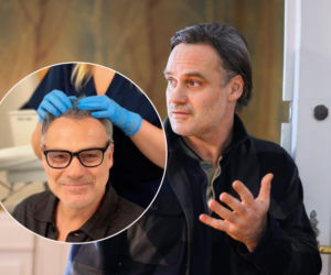 Wieczorkowski przeszedł przeszczep włosów! Pokazał się pół roku po zabiegu