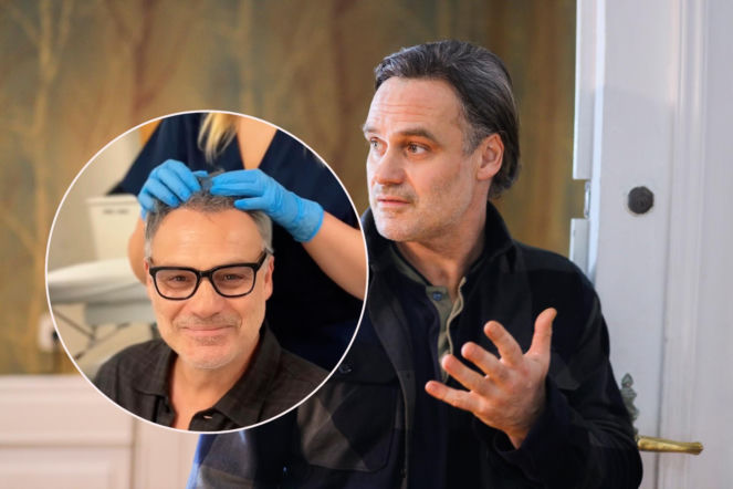 Wieczorkowski przeszedł przeszczep włosów! Pokazał się pół roku po zabiegu