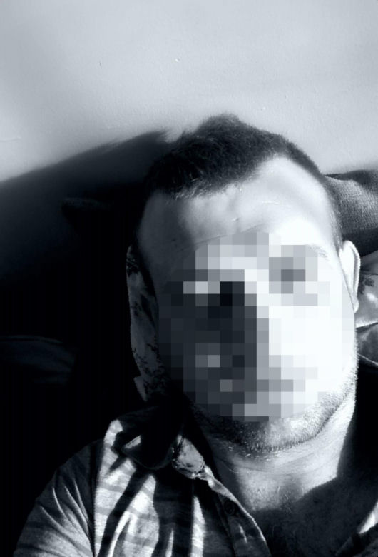 Dziewczynka wypadła z balkonu we Włocławku. Ojciec miał 1,7 promila