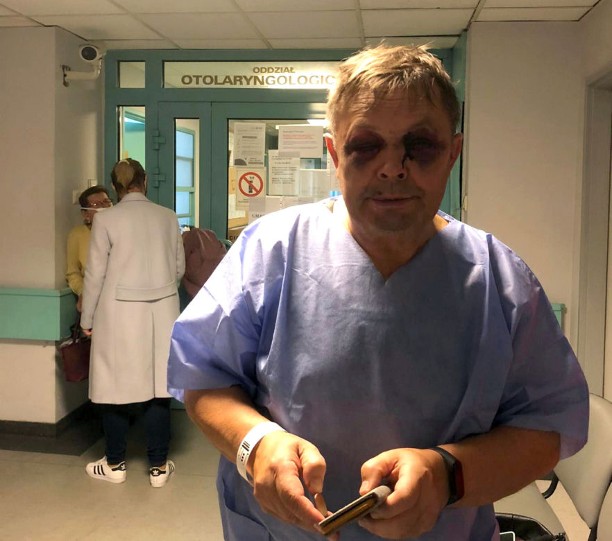 Bronił pasażerów, więc go skatowali