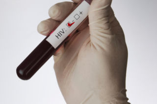 Badanie HIV w ciąży - zrób test na HIV w ciąży! Od tego zależy zdrowie twojego dziecka