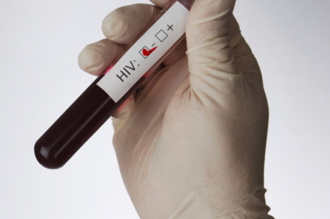 Zrób test na HIV