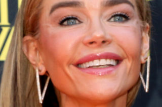 Denise Richards i jej lifting twarzy szokują. Aktorka się tłumaczy i pokazuje nagranie z zabiegu