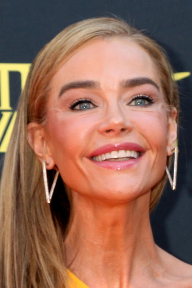 Denise Richards i jej lifting twarzy szokują. Aktorka się tłumaczy i pokazuje nagranie z zabiegu