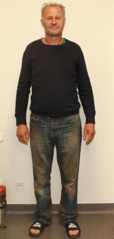 Strzelanina w Starej Wsi. Zginęły dwie osoby. Policja szuka 57-letniego mężczyzny