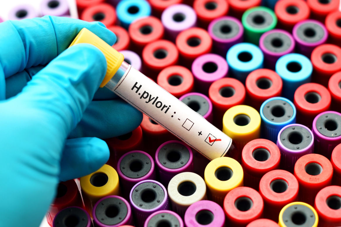 Czynniki rakotwórcze: Helicobacter pylori