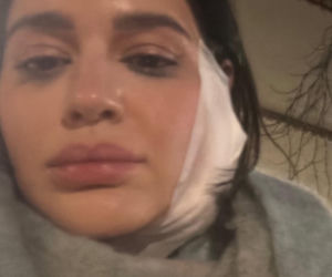 Honorata Skarbek pokazała obandażowaną twarz