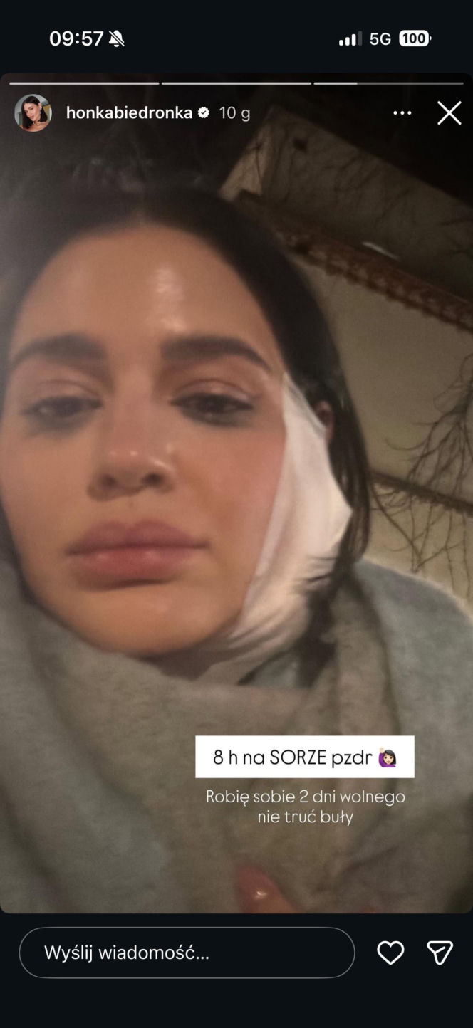 Honorata Skarbek pokazała obandażowaną twarz