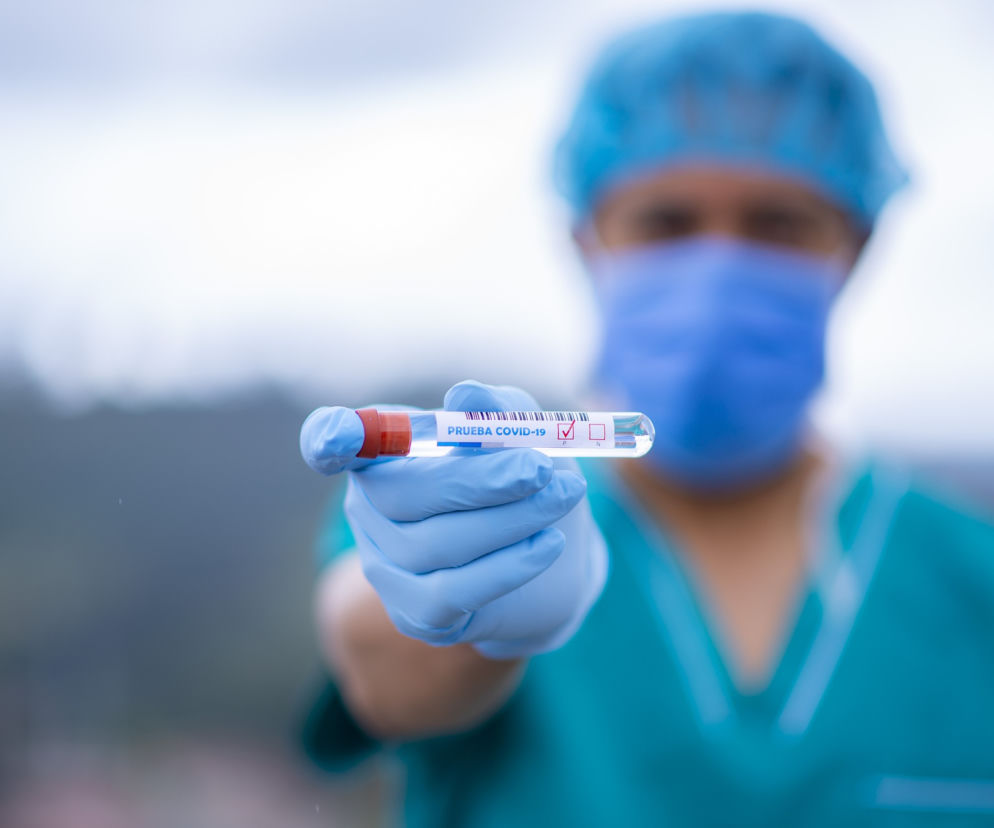 Koronawirus w regionie. Maleje liczba nowych zachorowań. W ciągu doby wykonano ok. 37 tysięcy testów 