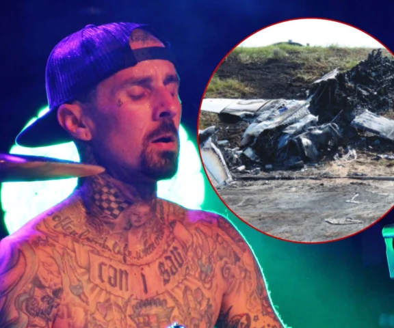 Niewyobrażalny ból i 26 operacji. Travis Barker przeszedł przez piekło na oddziale oparzeniowym