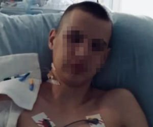 14-latek wspiął się na słup, obrażenia są ogromne. Wszystko przez Tik-Toka?! [ZDJĘCIA]