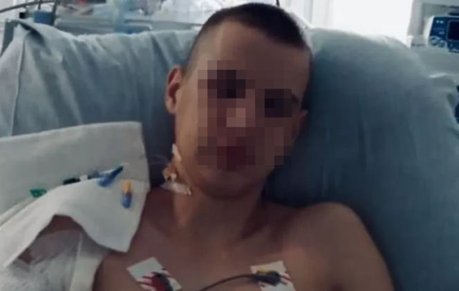 14-latek wspiął się na słup, obrażenia są ogromne. Wszystko przez Tik-Toka?! [ZDJĘCIA]