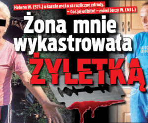 Żona mnie wykastrowała Żyletką