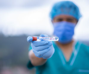 Ogniska koronawirusa na Podkarpaciu. Jak wygląda sytuacja?  Dane sanepidu z 27.08