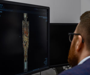 Niezwykły pacjent w szpitalu w Lublinie. To egipska mumia dziecka