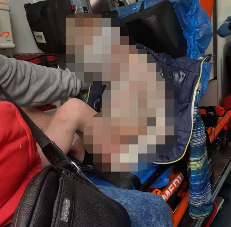 Częstochowa: 8-letni Kamilek pobity i poparzony. Ojczym z zarzutami taki?