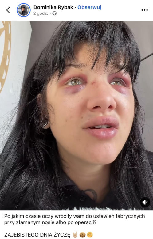 Dominika Rybak po walce