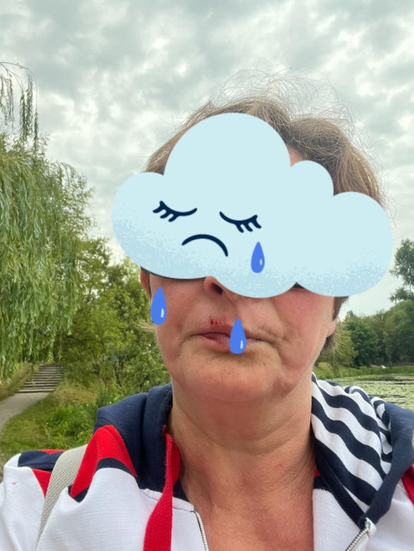 Kobieta pobita przez staruszka, bo zwróciła mu uwagę. "Przewrócił mnie na chodnik i okładał parasolką, potem uderzył pięścią w twarz"