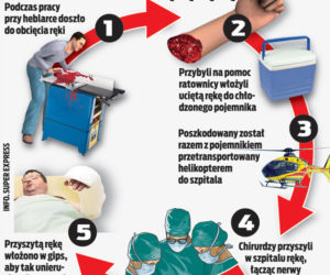 Lekarze przyszyli mi odciętą rękę