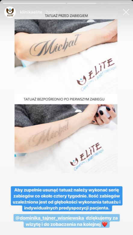 Dominika Tajner-Wiśniewska ciągle nosi na sobie Michała Wiśniewskiego