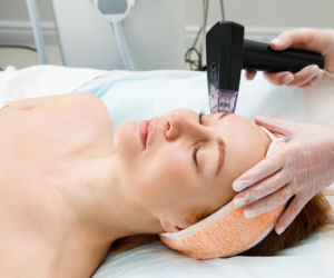 Zapomnij o wstydliwych bliznach. Ten zabieg „wymusza” na skórze produkcję nowego kolagenu