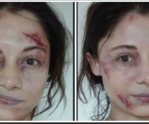 M jak miłość. Adriana Kalska (Iza Lewińska) pobita