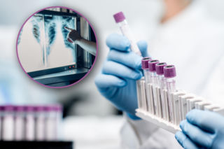 Gruźlica w szkole. Sanepid uspokaja: Sytuacja pod pełnym nadzorem