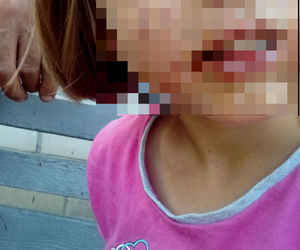 Spaliła kwasem ucho Julii. Rodzina broni wyrodnej matki, która latami torturowała 10-latkę