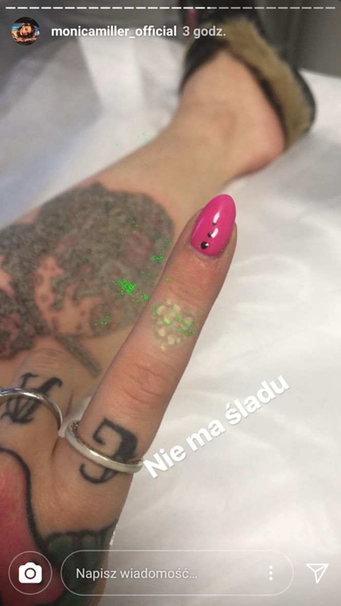 Wnuczka Millera usuwa tatuaże