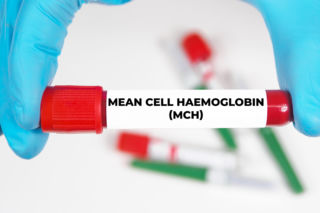 MCH – co oznacza i kiedy warto zbadać?