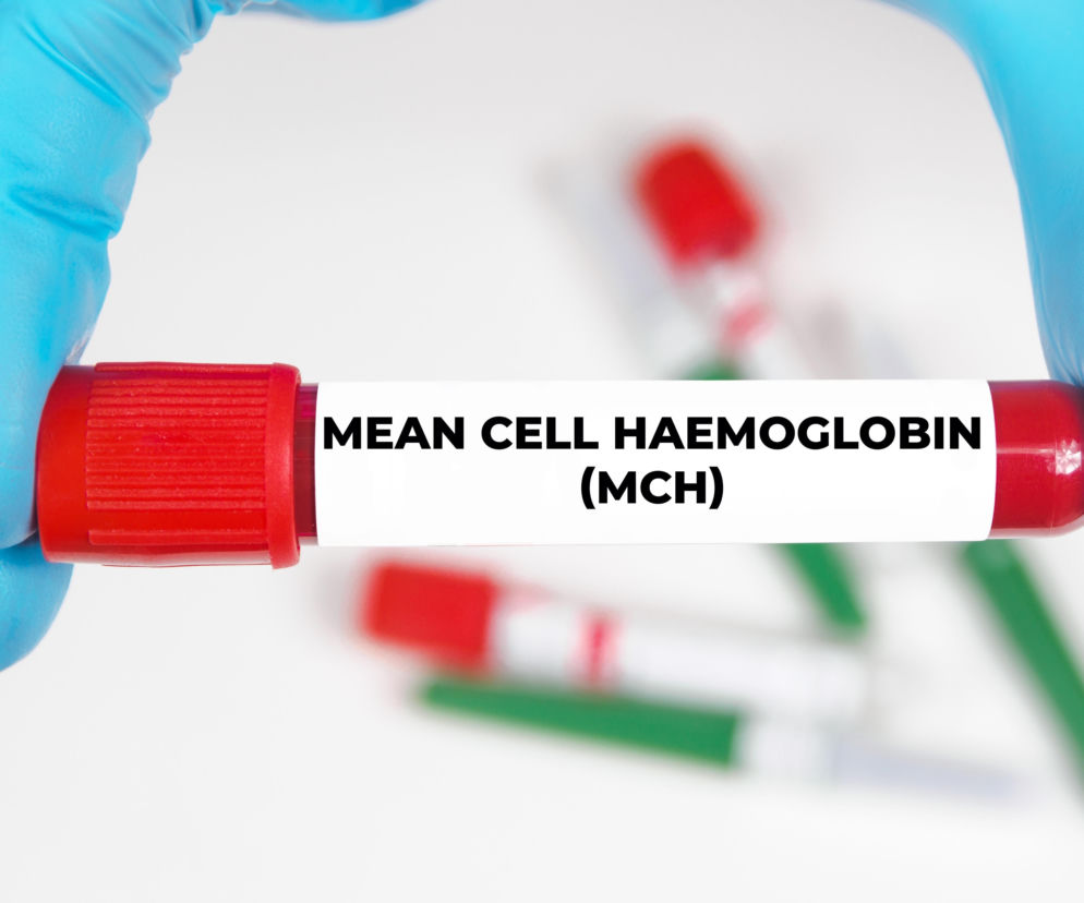 Dłonie w niebieskich rękawiczkach trzymają probówkę z napisem MEAN CELL HAEMOGLOBIN (MCH), symbolizującą badanie krwi i diagnostykę. Temat MCH, czyli średniej masy hemoglobiny w krwince czerwonej, opisano na portalu Poradnik Zdrowie.