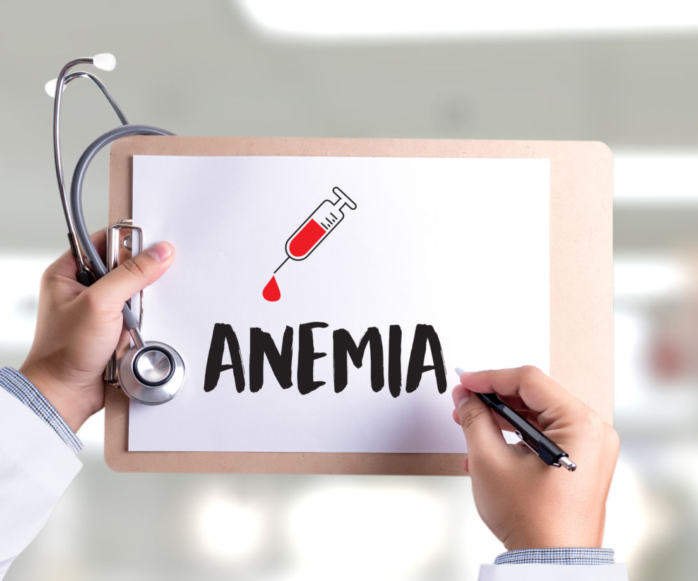 Anemia