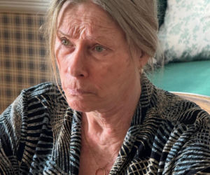 Co się stało z twarzą Małgorzaty Potockiej?!