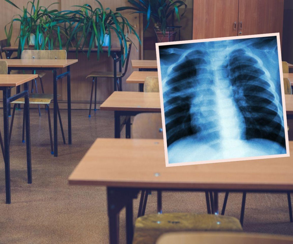 Nauczycielka z gruźlicą miała kontakt z setkami uczniów. Chorowała od miesięcy