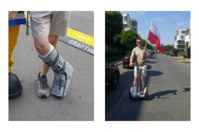 Filip Chajzer ZŁAMAŁ NOGĘ, ale dobry humor go nie opuszcza!