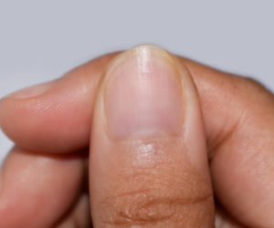 Masz takie zmiany w półksiężycu na paznokciu? Mogą zdradzać ukryte problemy z sercem i tarczycą