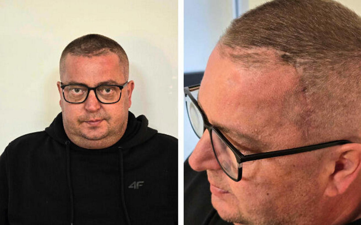 Dariusz walczy z wielkim guzem. "Prosimy wszystkich o pomoc"