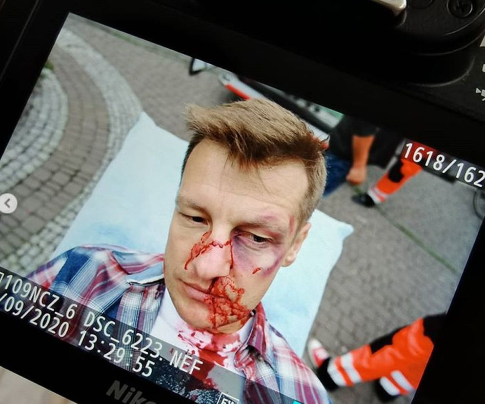M jak miłość. Paweł (Rafał Mroczek) pobity