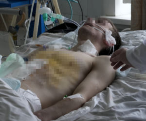 Ukraina/ 21 zabitych, ponad 110 rannych po atakach w Charkowie i Kijowie