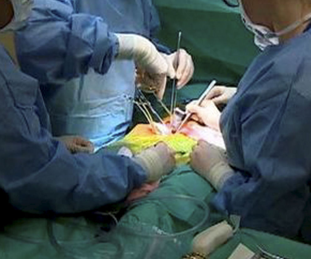 operacja, nerka, przeszczep, lekarz, doktor, sala operacyjna