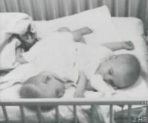 Przeżyli zrośnięci 68 lat. Nie żyją najdłużej żyjące bliźnięta syjamskie. Ronnie i Donnie Galyon