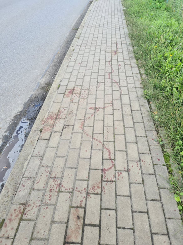 Leżajsk. Obciął dłoń maczetą [ZDJĘCIA]