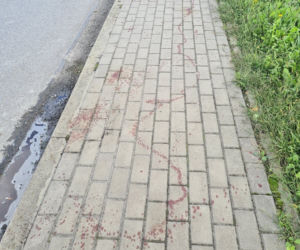 Leżajsk. Obciął dłoń maczetą [ZDJĘCIA]